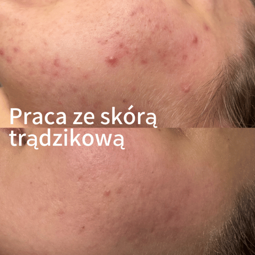 Onkokosmetologia Poznań