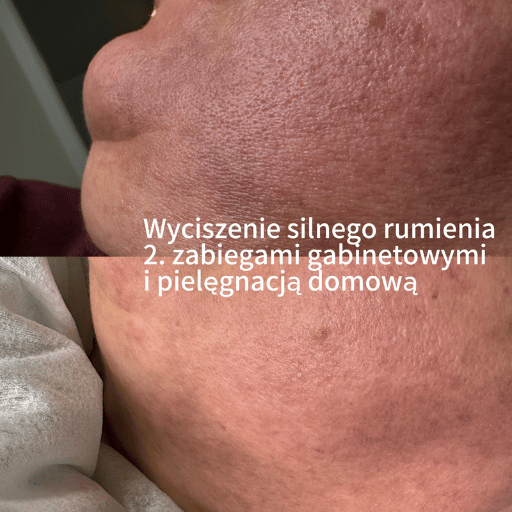 Onkokosmetologia Poznań