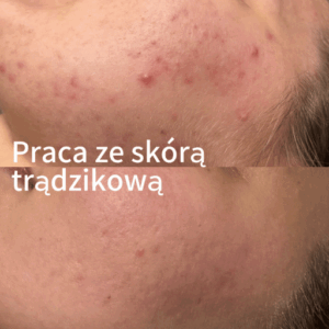 Weronika Majchrzak Kosmetologia