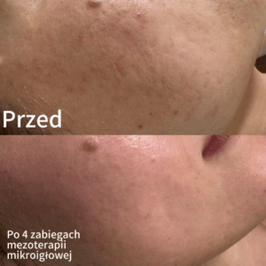 Weronika Majchrzak Kosmetologia