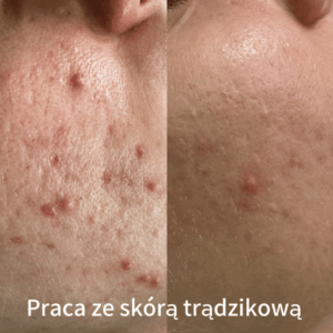 Weronika Majchrzak Kosmetologia