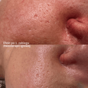 Weronika Majchrzak Kosmetologia