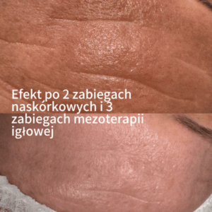 Weronika Majchrzak Kosmetologia