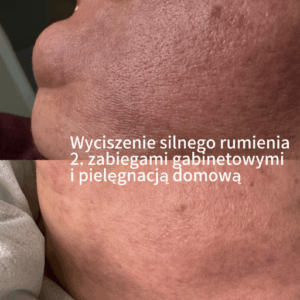 Weronika Majchrzak Kosmetologia