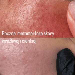 Weronika majchrzak kosmetolog